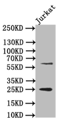 Western Blot. Positive WB detected in: JK whole cell lysate. All lanes: EBI3 antibody at 1:500. Secondary. Goat polyclonal to rabbit IgG at 1/50000 dilution. Predicted band size: 25 kDa. Observed band size: 25 kDa. 