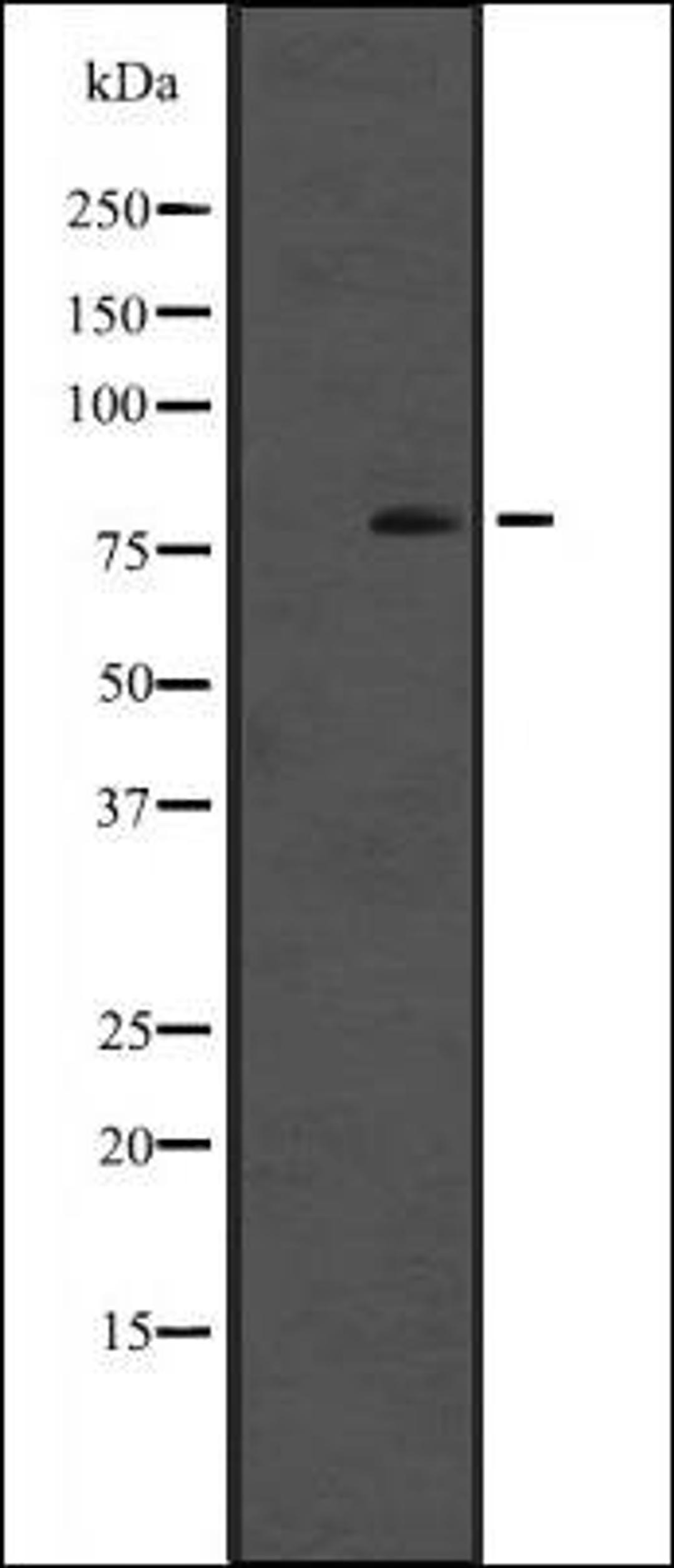 Western blot analysis of A431 whole cell lysate using Cytochrome P450 reductase antibody