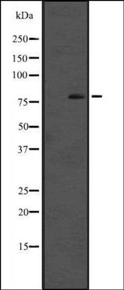 Western blot analysis of A431 whole cell lysate using Cytochrome P450 reductase antibody