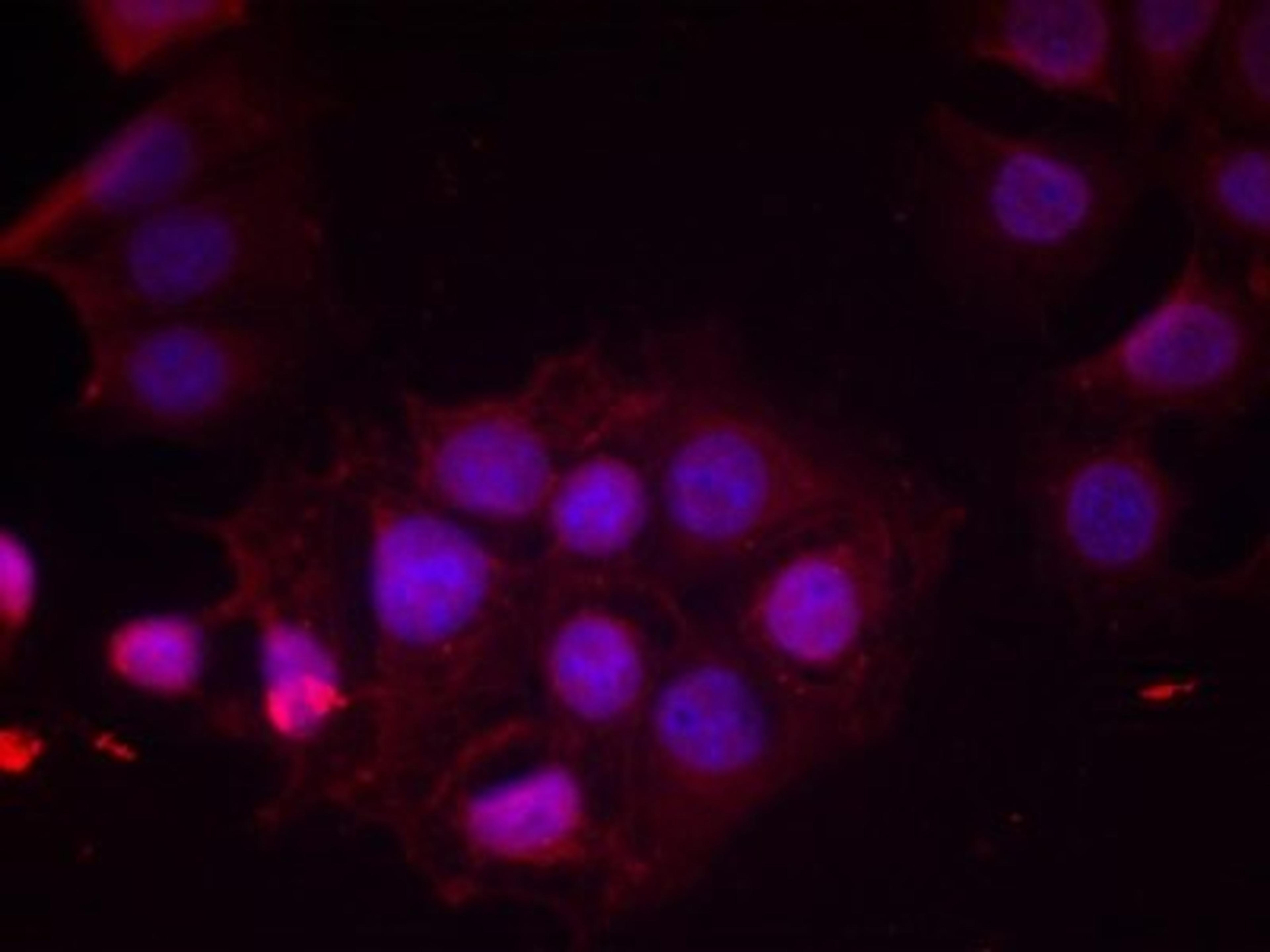 Immunocytochemistry/Immunofluorescence: Estrogen Receptor alpha [p Ser118] Antibody [NB100-81913] - Staining of methanol-fixed MCF cells using Estrogen Receptor-alpha (Phospho-Ser118) antibody.