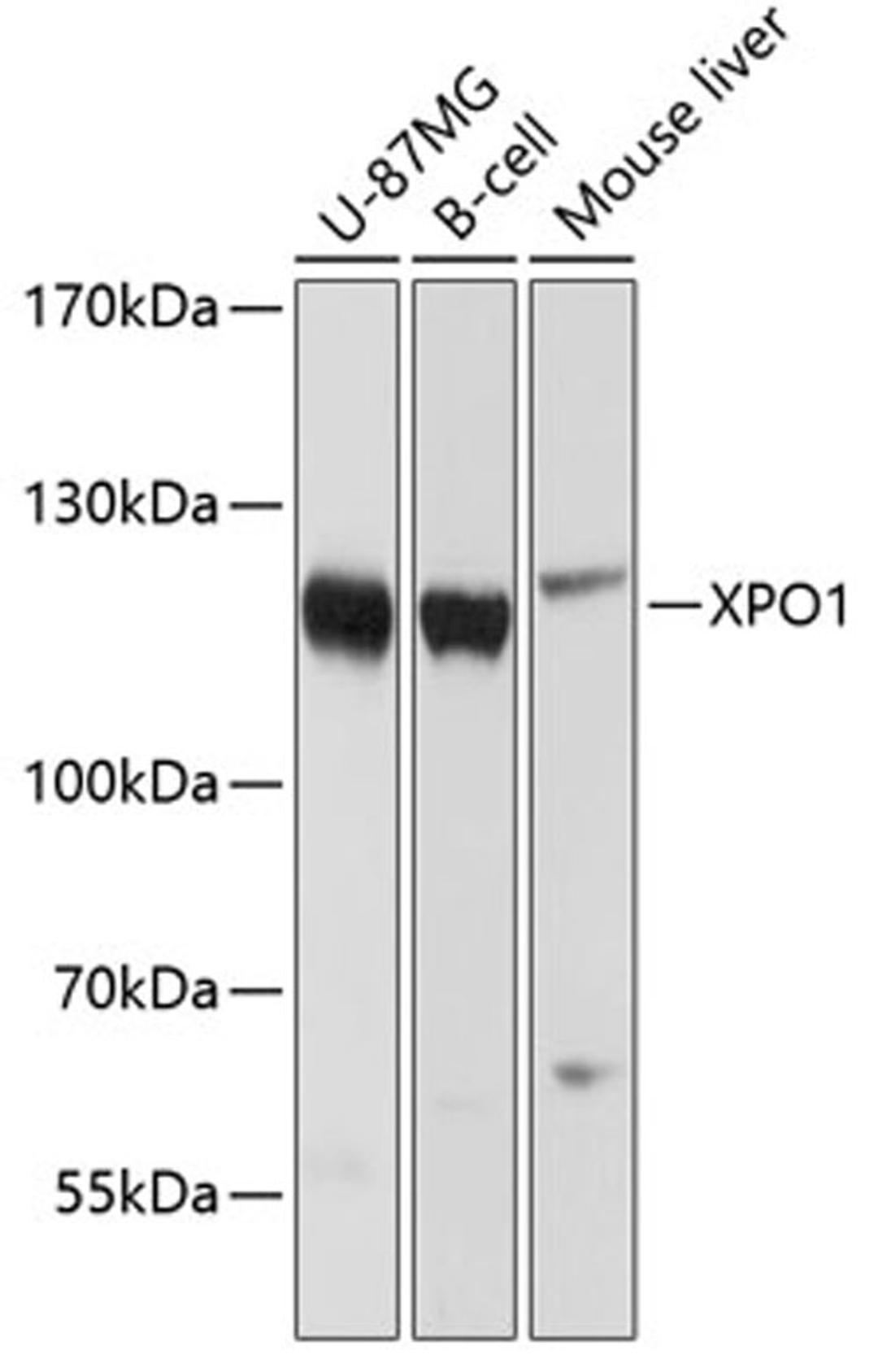 Western blot - XPO1 antibody (A0299)