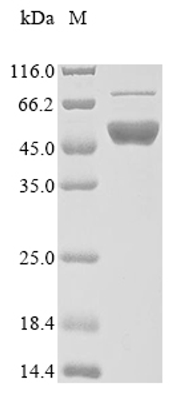 (Tris-Glycine gel) Discontinuous SDS-PAGE (reduced) with 5% enrichment gel and 15% separation gel.