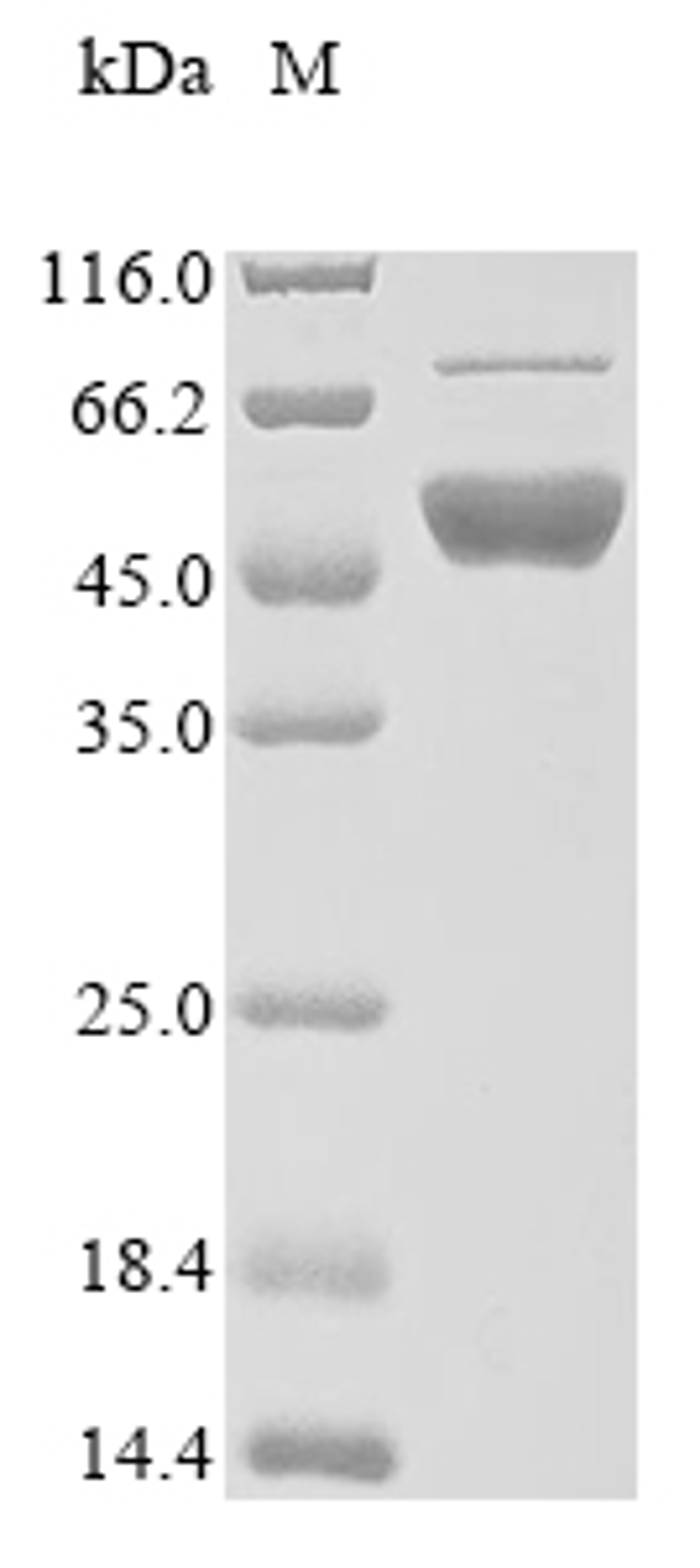 (Tris-Glycine gel) Discontinuous SDS-PAGE (reduced) with 5% enrichment gel and 15% separation gel.