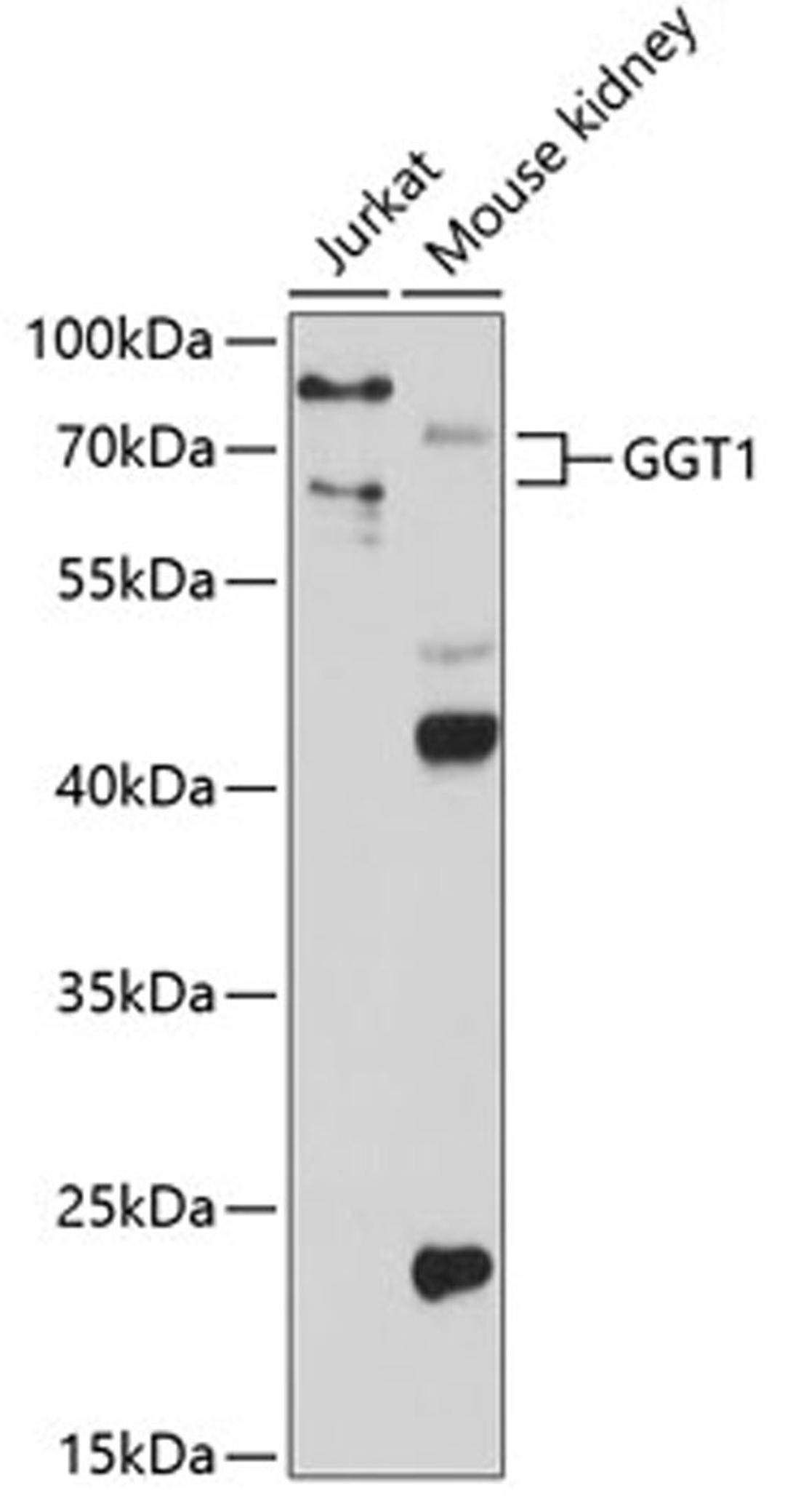 Western blot - GGT1 antibody (A1776)