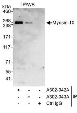 Detection of human Myosin-10 by western blot of immunoprecipitates.