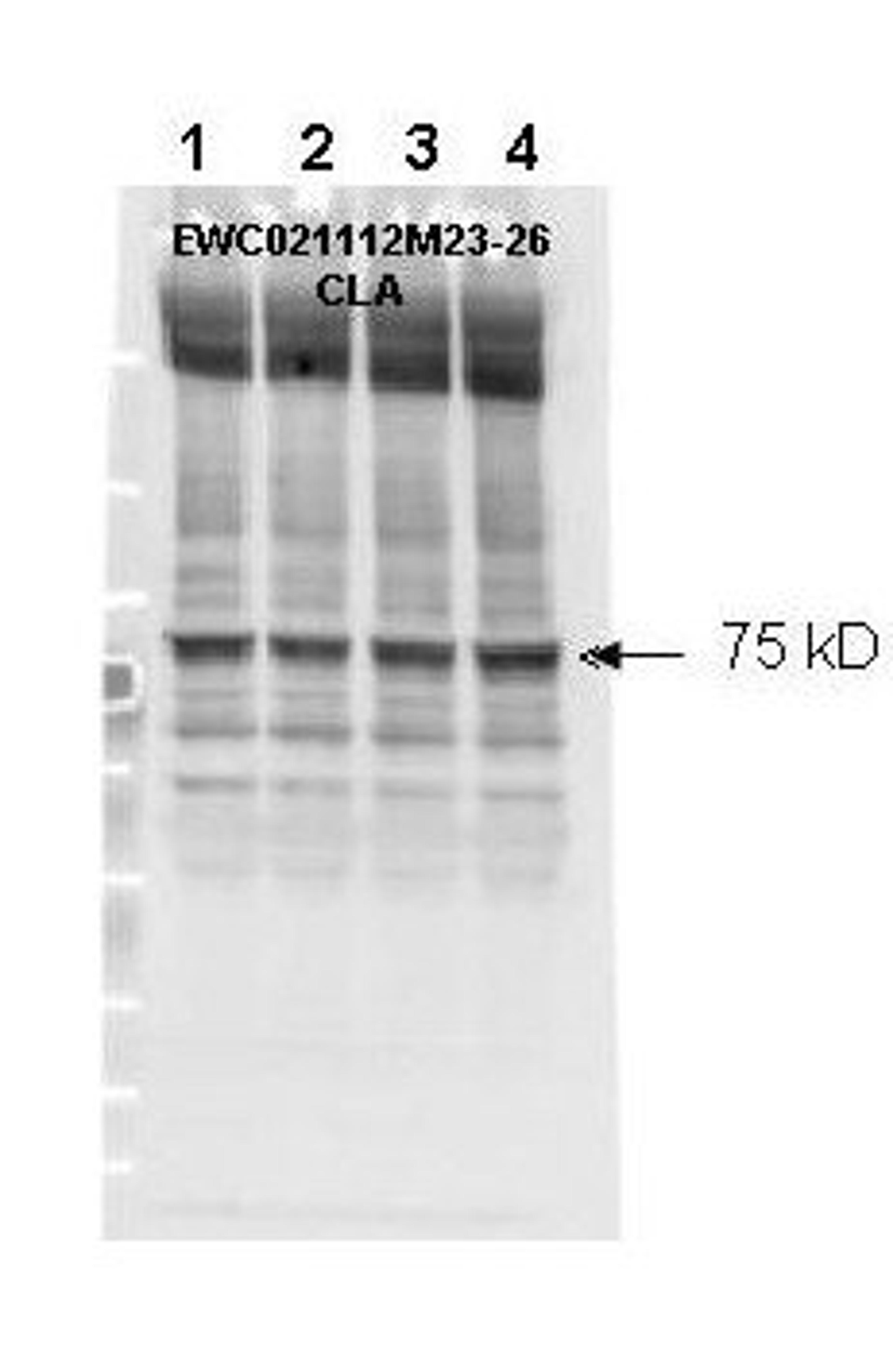 Western blot analysis of mouse cardiac myocyte lysate using NF2 (phospho-S518) antibody