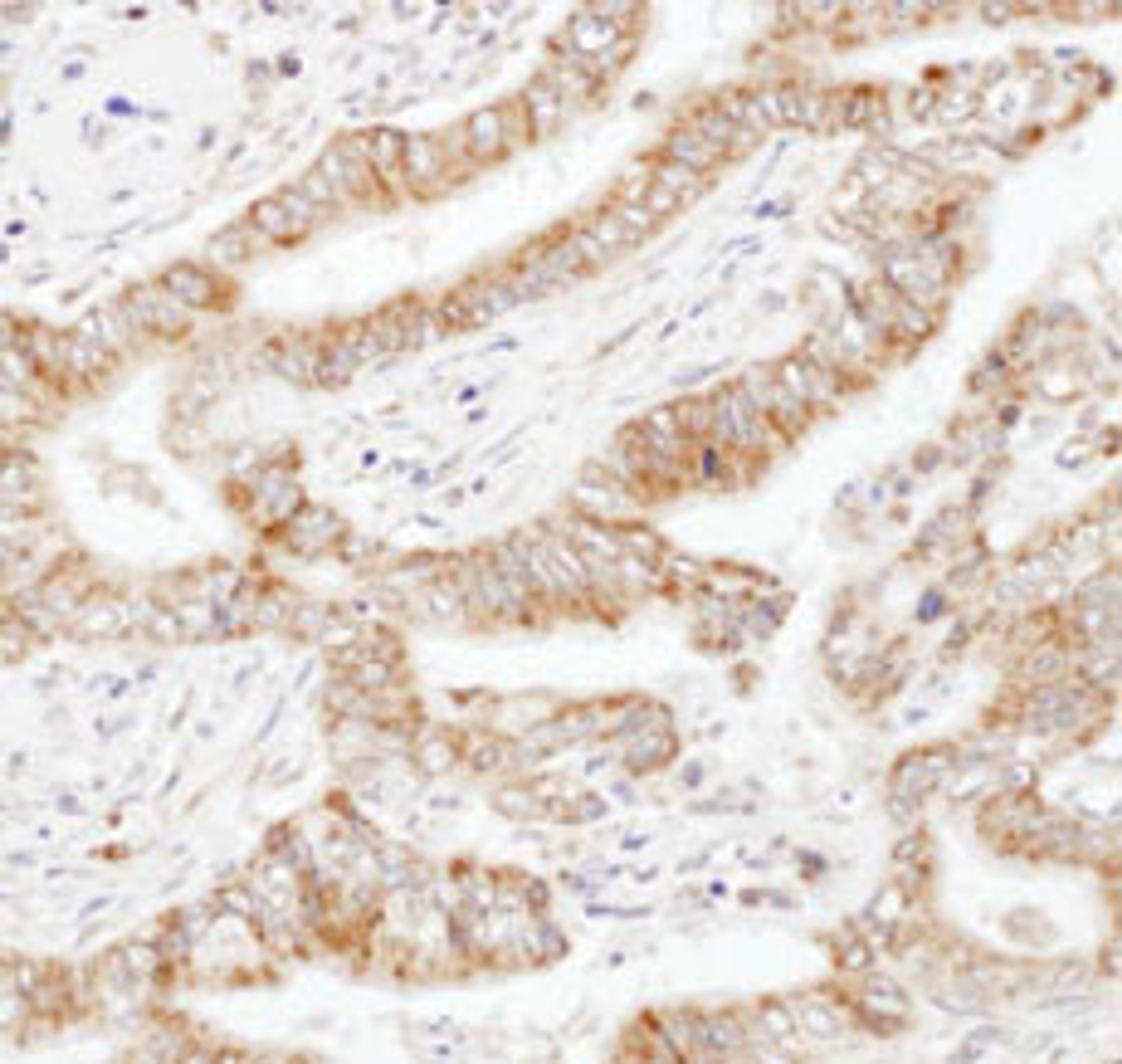 Detection of human UBAC1 by immunohistochemistry.