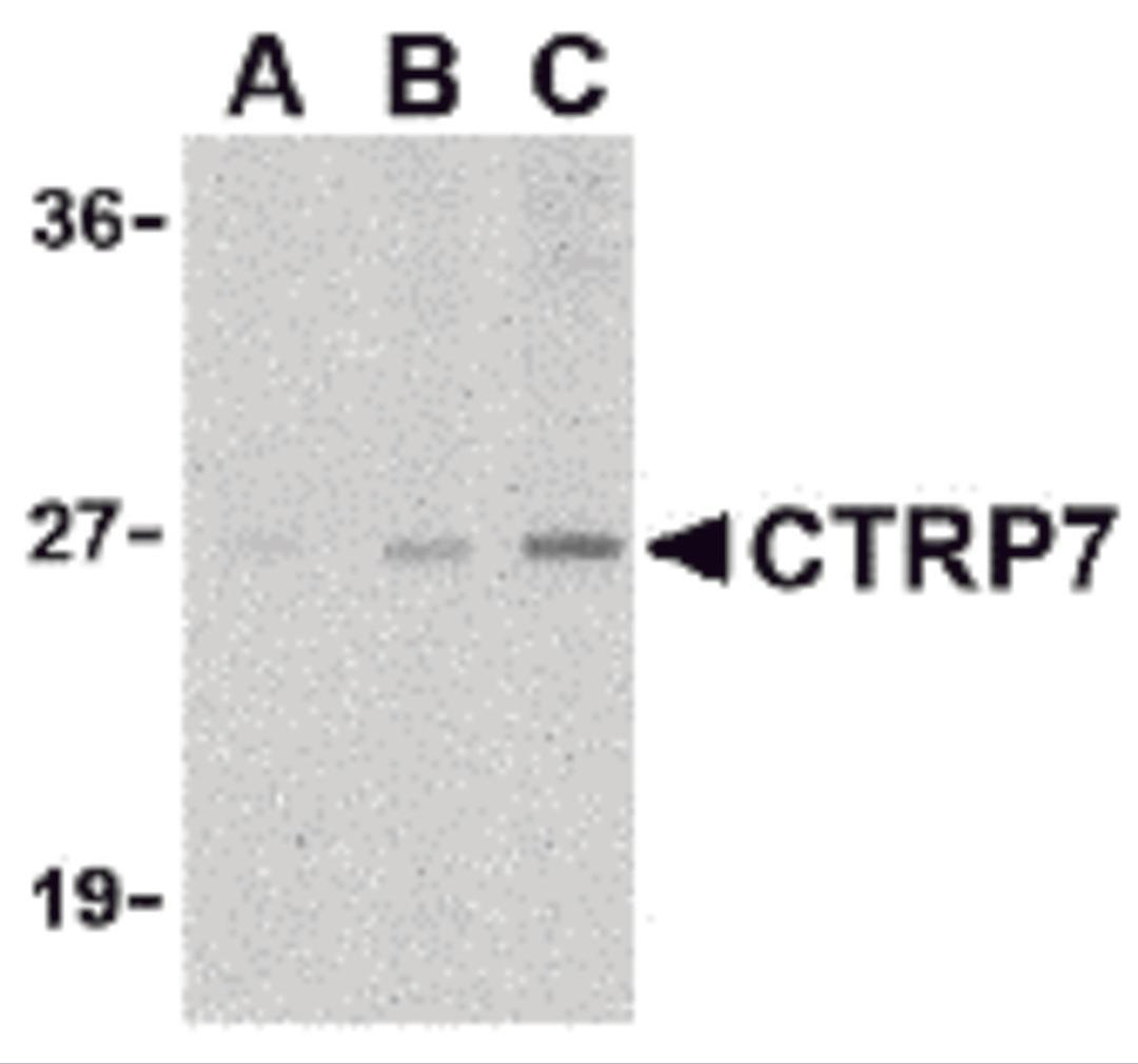 Western blot analysis of CTRP7 in 3T3 cell lysate with CTRP7 antibody at (A) 1, (B) 2, and (C) 4 μg/mL.