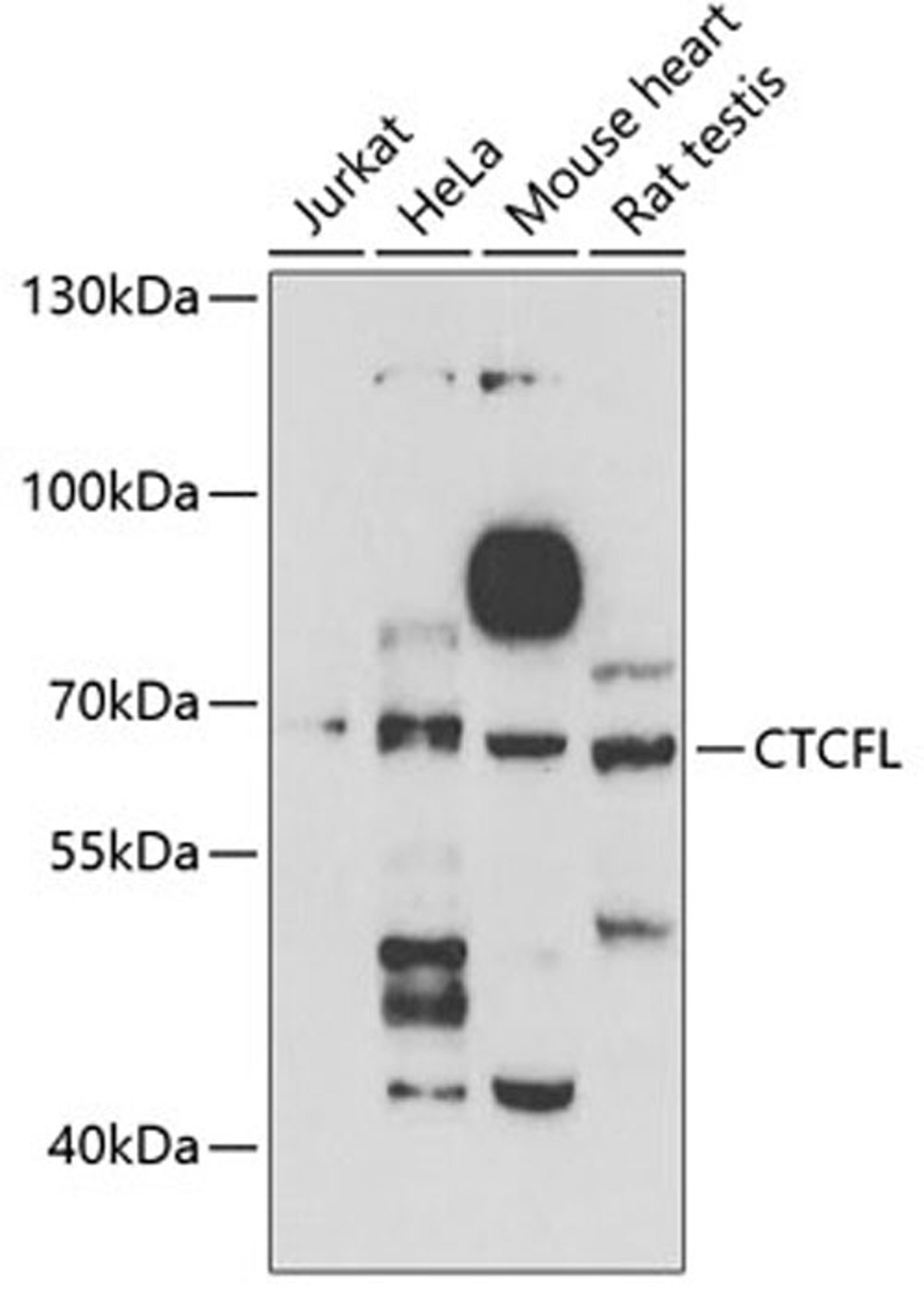 Western blot - CTCFL antibody (A6149)