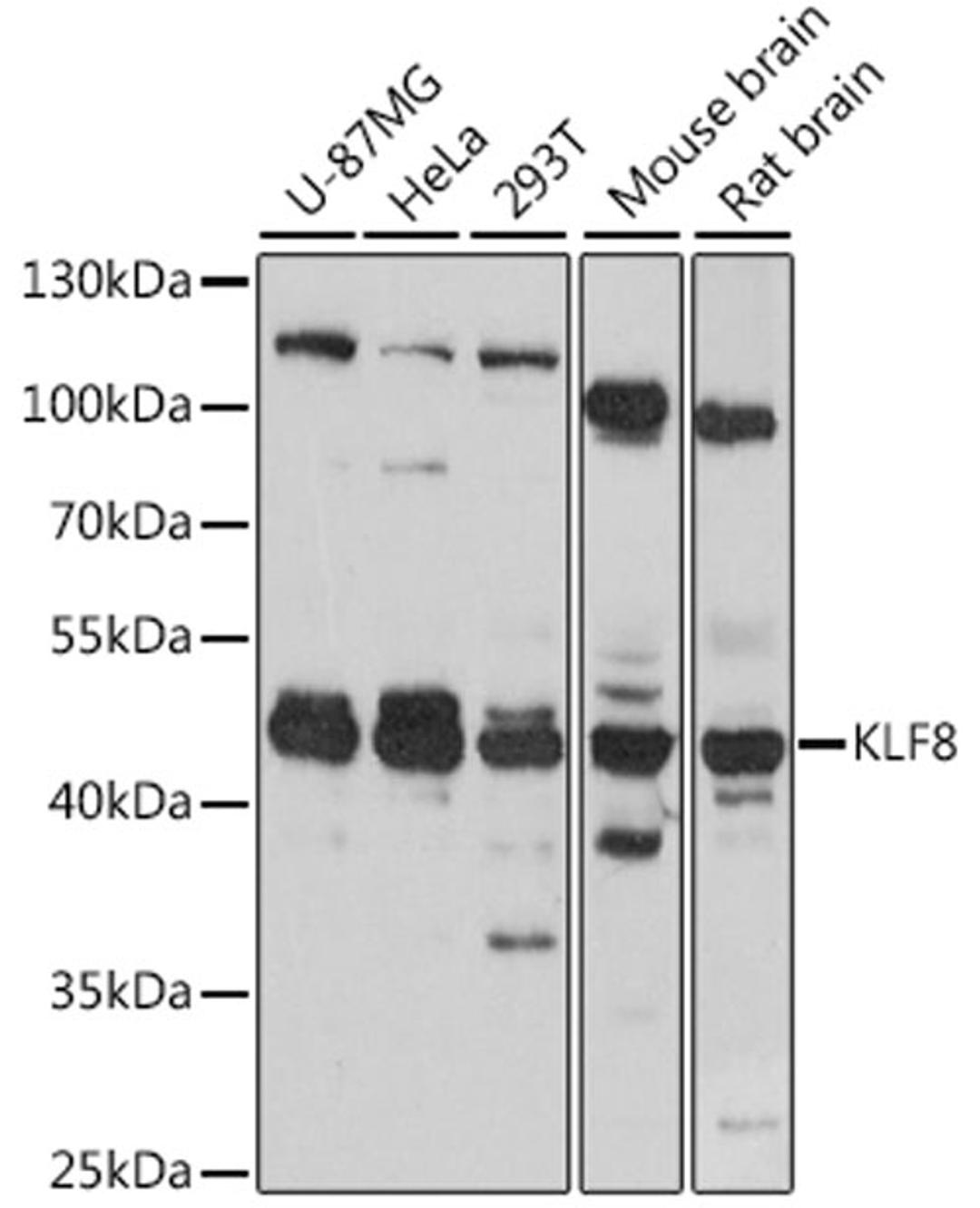 Western blot - KLF8 antibody (A16321)