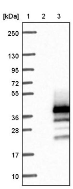 Western Blot: SIGLEC1 Antibody [NBP2-14794] - Lane 1: Marker [kDa] 250, 130, 95, 72, 55, 36, 28, 17, 10<br/>Lane 2: Negative control (vector only transfected HEK293T lysate)<br/>Lane 3: Over-expression lysate (Co-expressed with a C-terminal myc-DDK tag (~3.1 kDa) in mammalian HEK293T cells, LY406523)