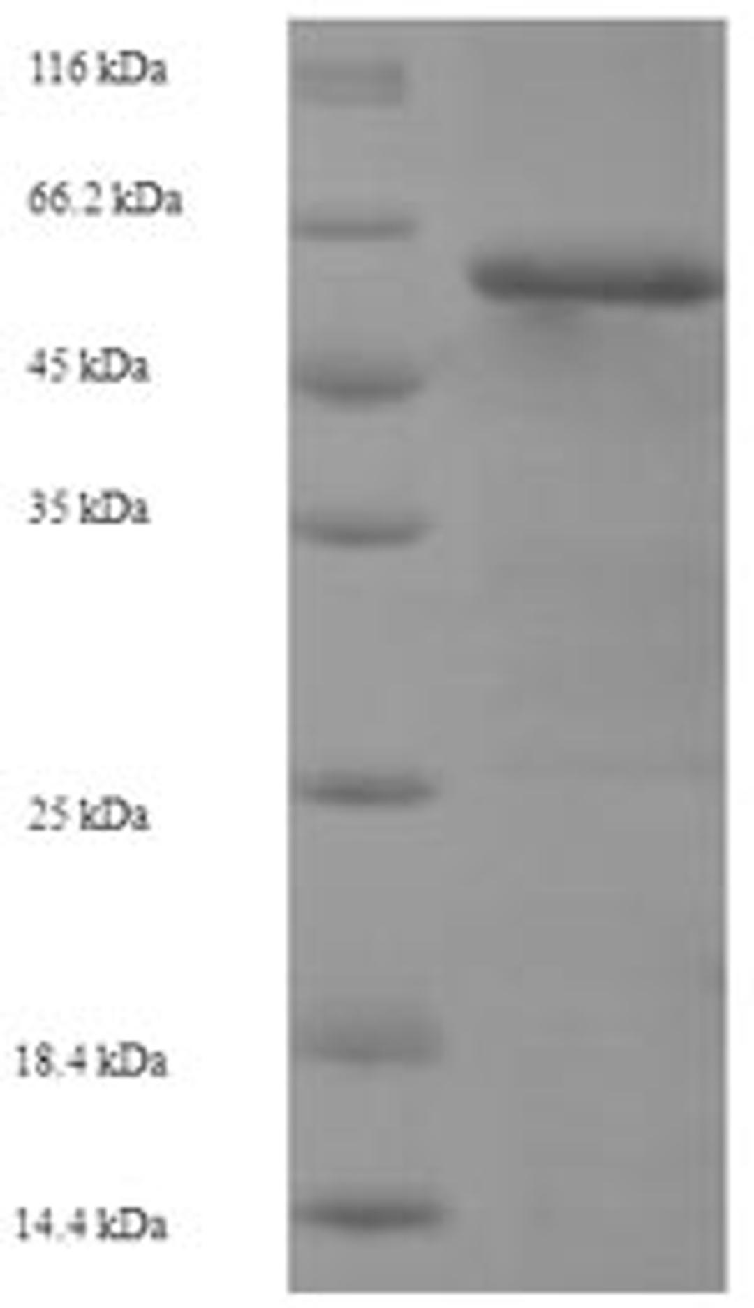 (Tris-Glycine gel) Discontinuous SDS-PAGE (reduced) with 5% enrichment gel and 15% separation gel.