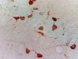 Immunohistochemical analysis of paraffin-embedded mice brain tissue using GAD67 antibody