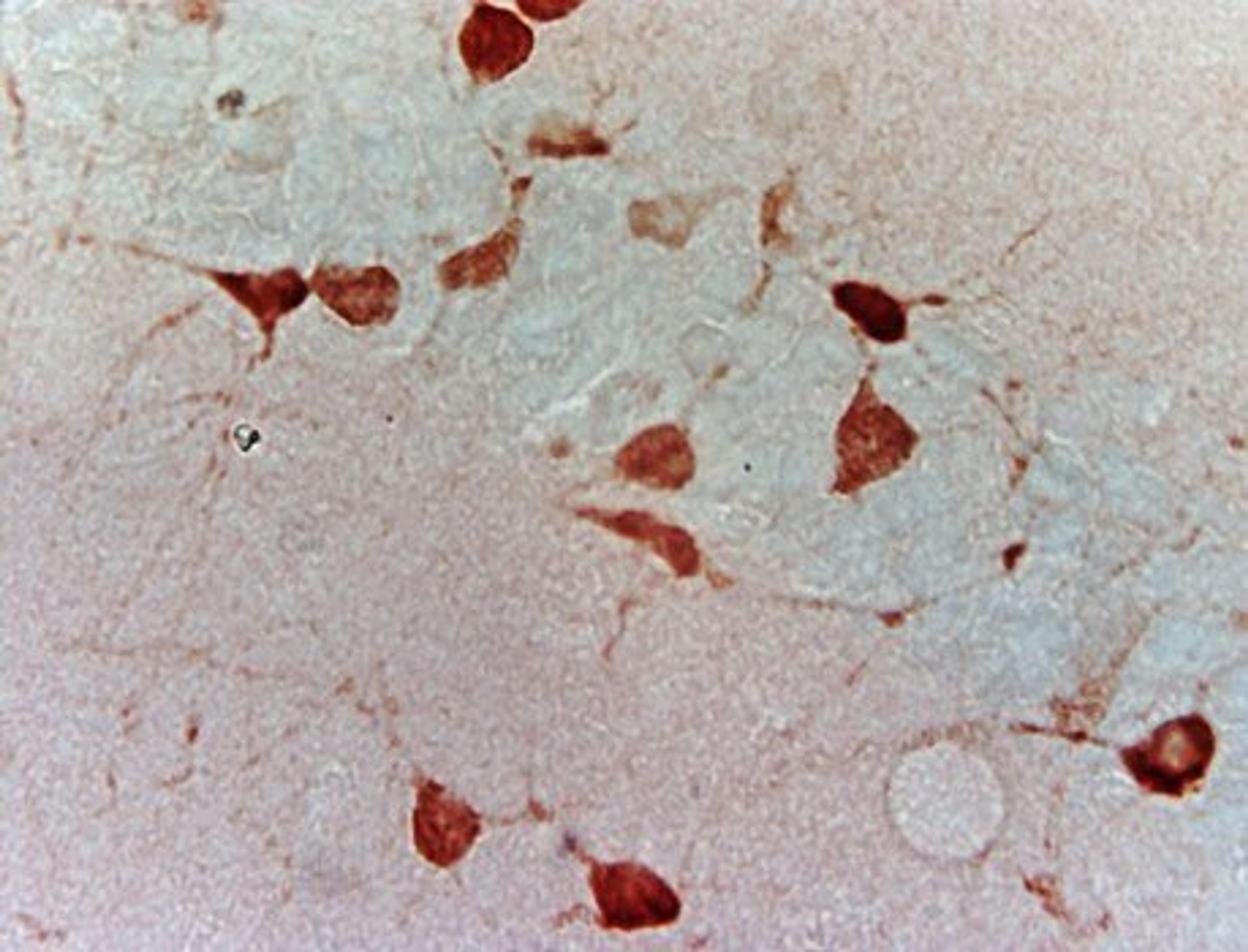 Immunohistochemical analysis of paraffin-embedded mice brain tissue using GAD67 antibody