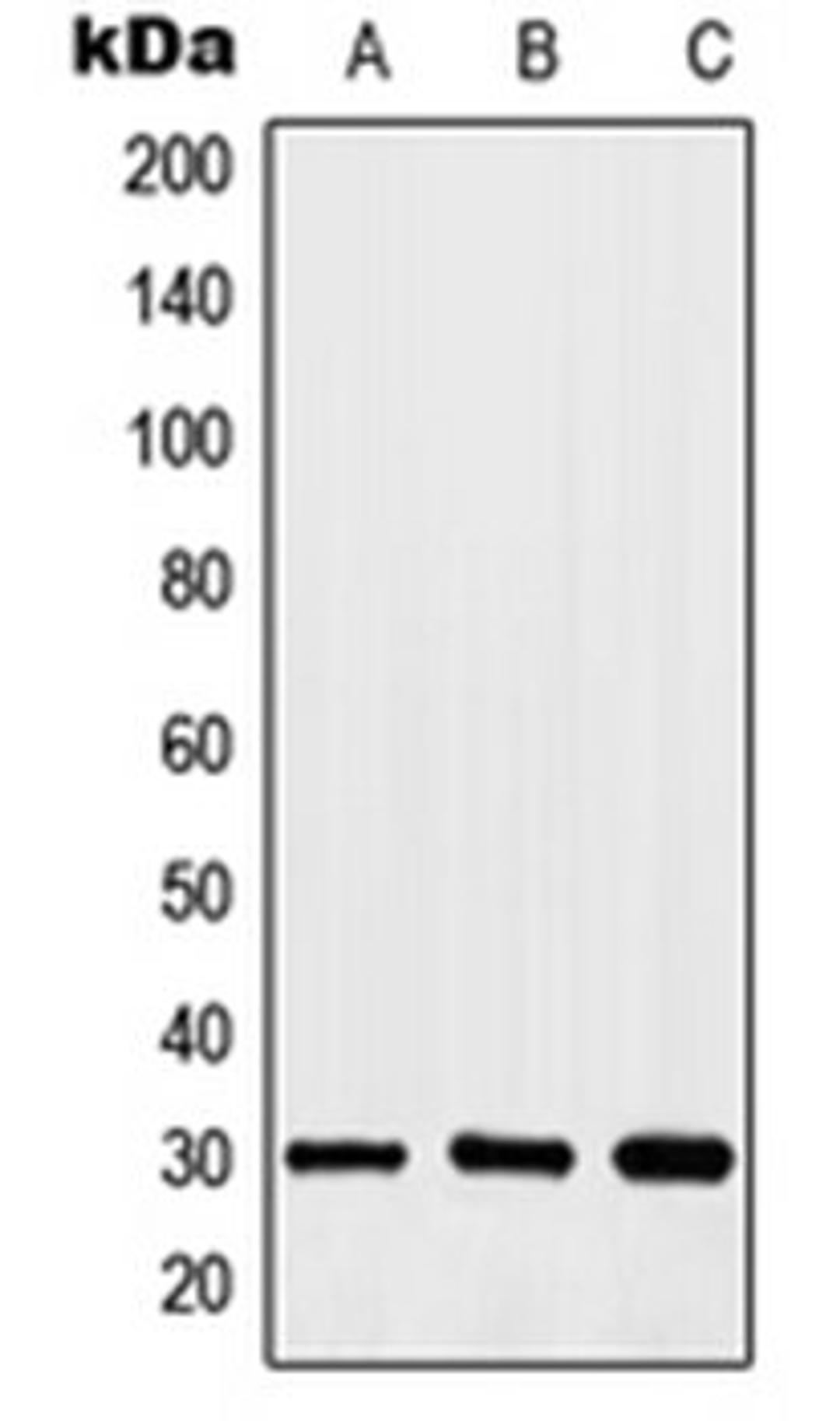 Western blot analysis of HEK293T (Lane 1), HeLa (Lane 2), K562 (Lane 3) whole cell lysates using HOXA11 antibody