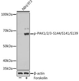 Western blot - Phospho-PAK1/2/3-S144/S141/S139 Rabbit mAb (AP1158)