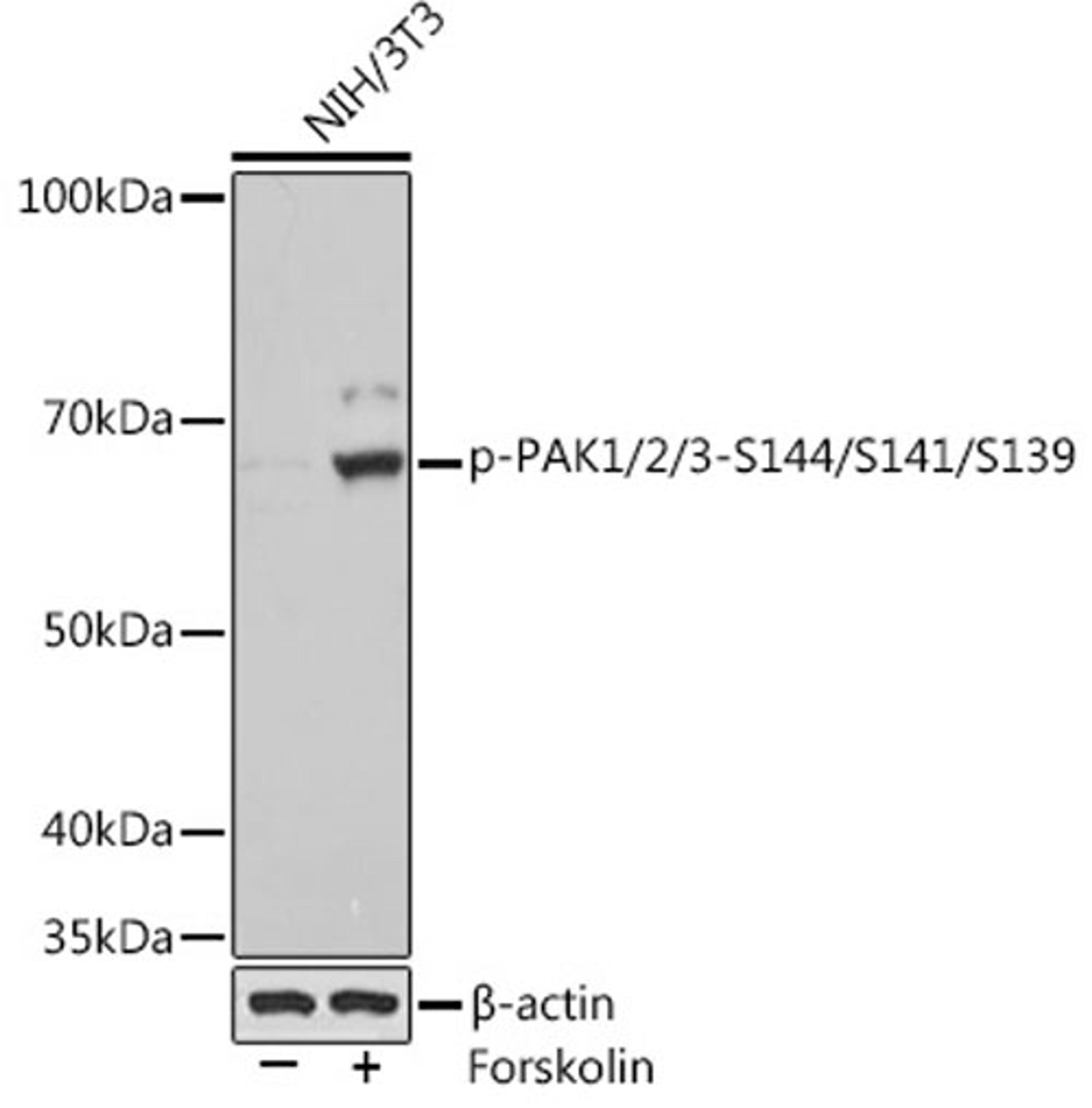 Western blot - Phospho-PAK1/2/3-S144/S141/S139 Rabbit mAb (AP1158)