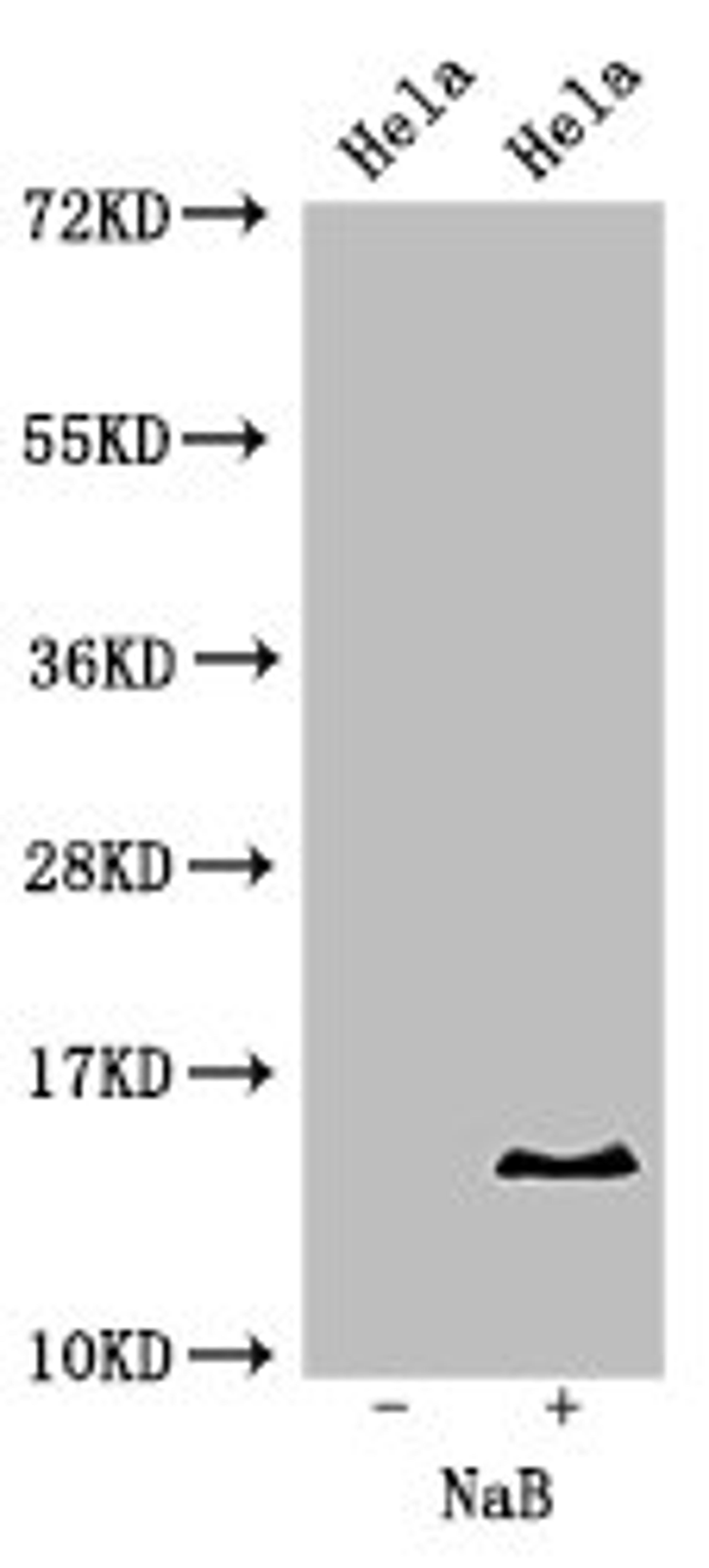 Western Blot. Positive WB detected in: Hela cell acid extracts treated by NaB. All lanes: HIST1H2BB antibody at 2µg/ml. Secondary. Goat polyclonal to rabbit IgG at 1/50000 dilution. Predicted band size: 14 kDa. Observed band size: 14 kDa