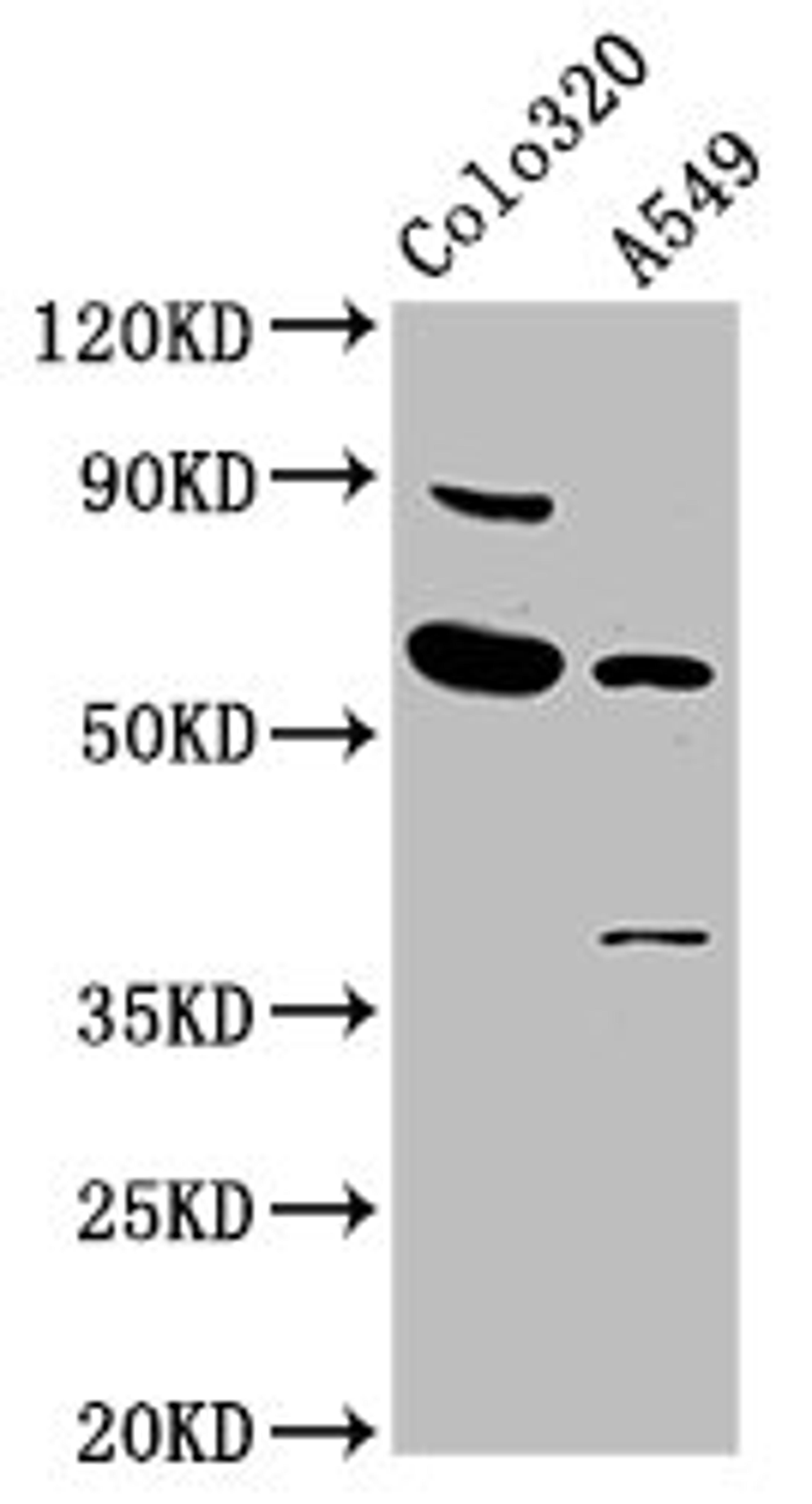 Western Blot. Positive WB detected in: Colo320 whole cell lysate, A549 whole cell lysate. All lanes: EBF3 antibody at 5.6ug/ml. Secondary. Goat polyclonal to rabbit IgG at 1/50000 dilution. Predicted band size: 65, 61 kDa. Observed band size: 65 kDa. 
