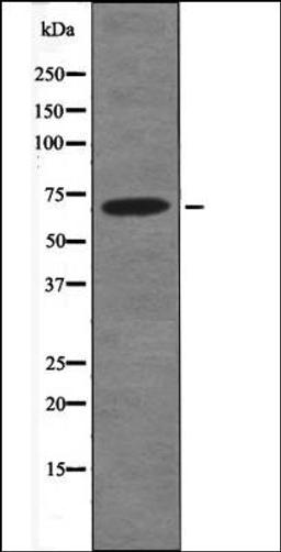 Western blot analysis of TNF- treated HeLa whole cell lysates using Kv3.4/KCNC4 -Phospho-Ser15- antibody