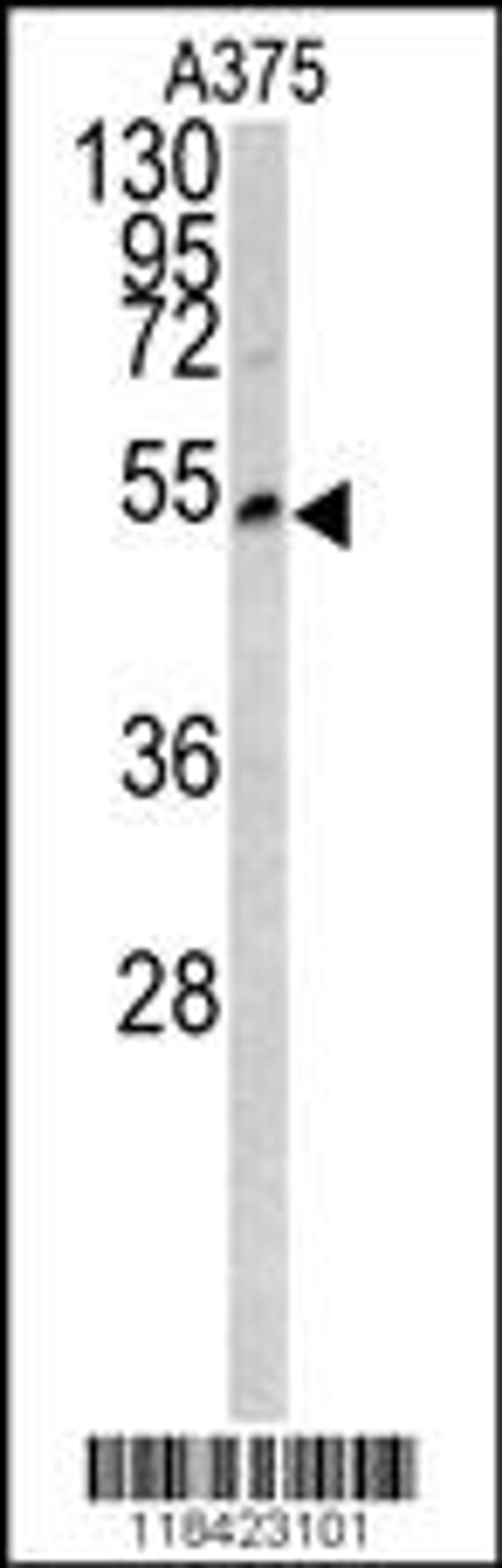 Western blot analysis of LUM antibody in A375 cell line lysates (35ug/lane)