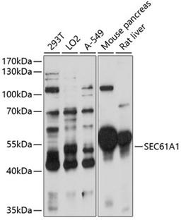 Western blot - SEC61A1 antibody (A11658)