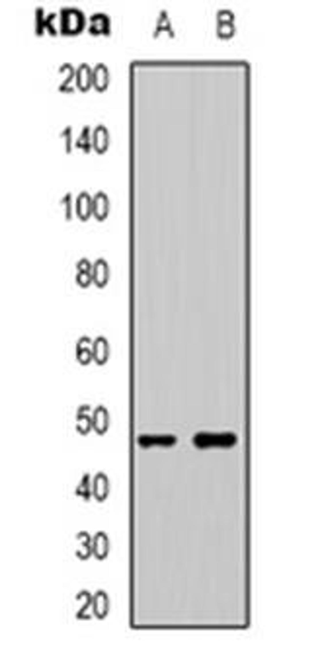 Western blot analysis of CADM2 expression in HepG2 (Lane 1), mouse brain (Lane 2) whole cell lysates using CADM2 antibody