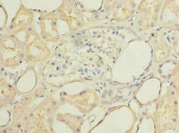 Immunohistochemistry of paraffin-embedded human kidney tissue using CSB-PA819898LA01HU at dilution of 1:100