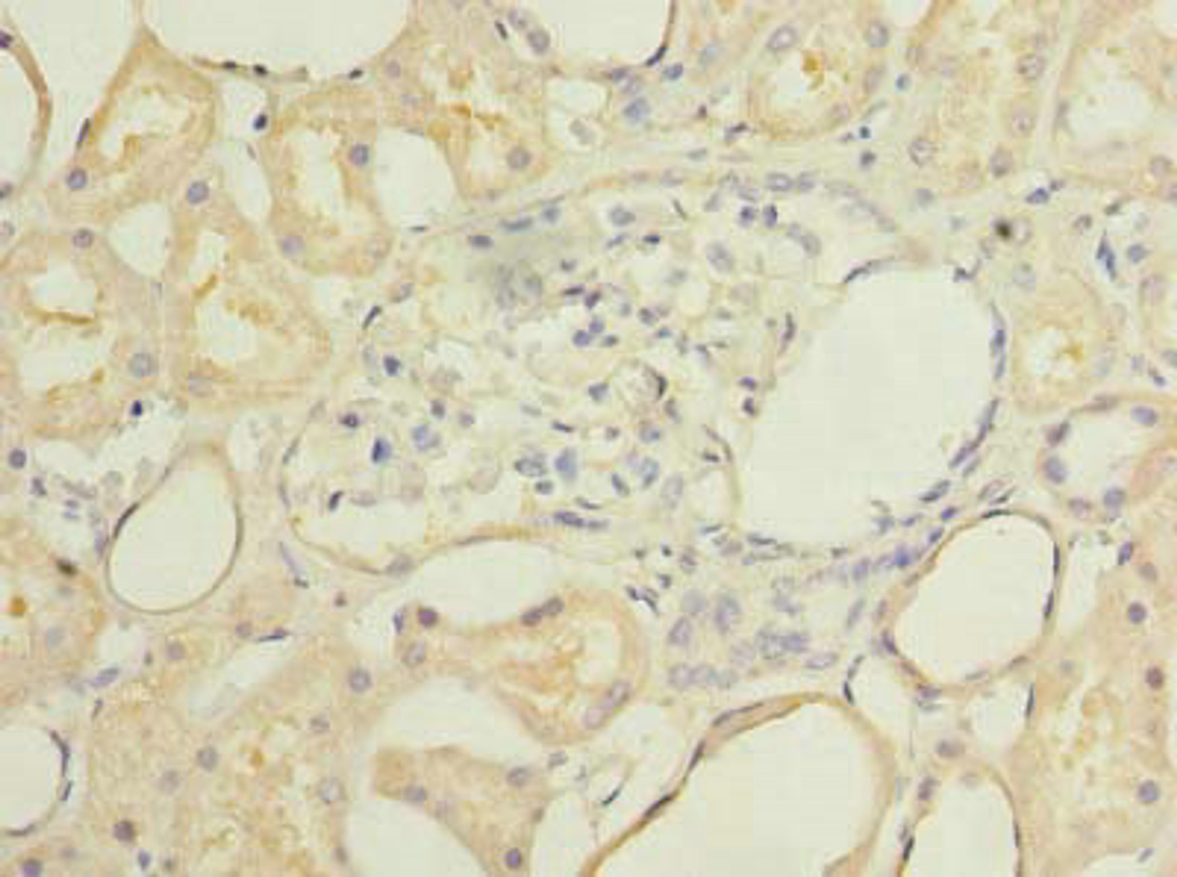 Immunohistochemistry of paraffin-embedded human kidney tissue using CSB-PA819898LA01HU at dilution of 1:100