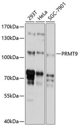 Western blot - PRMT9 antibody (A10491)