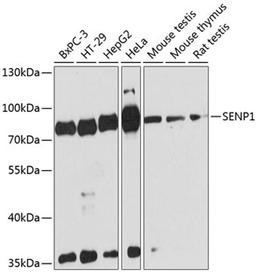 Western blot - SENP1 antibody (A13086)