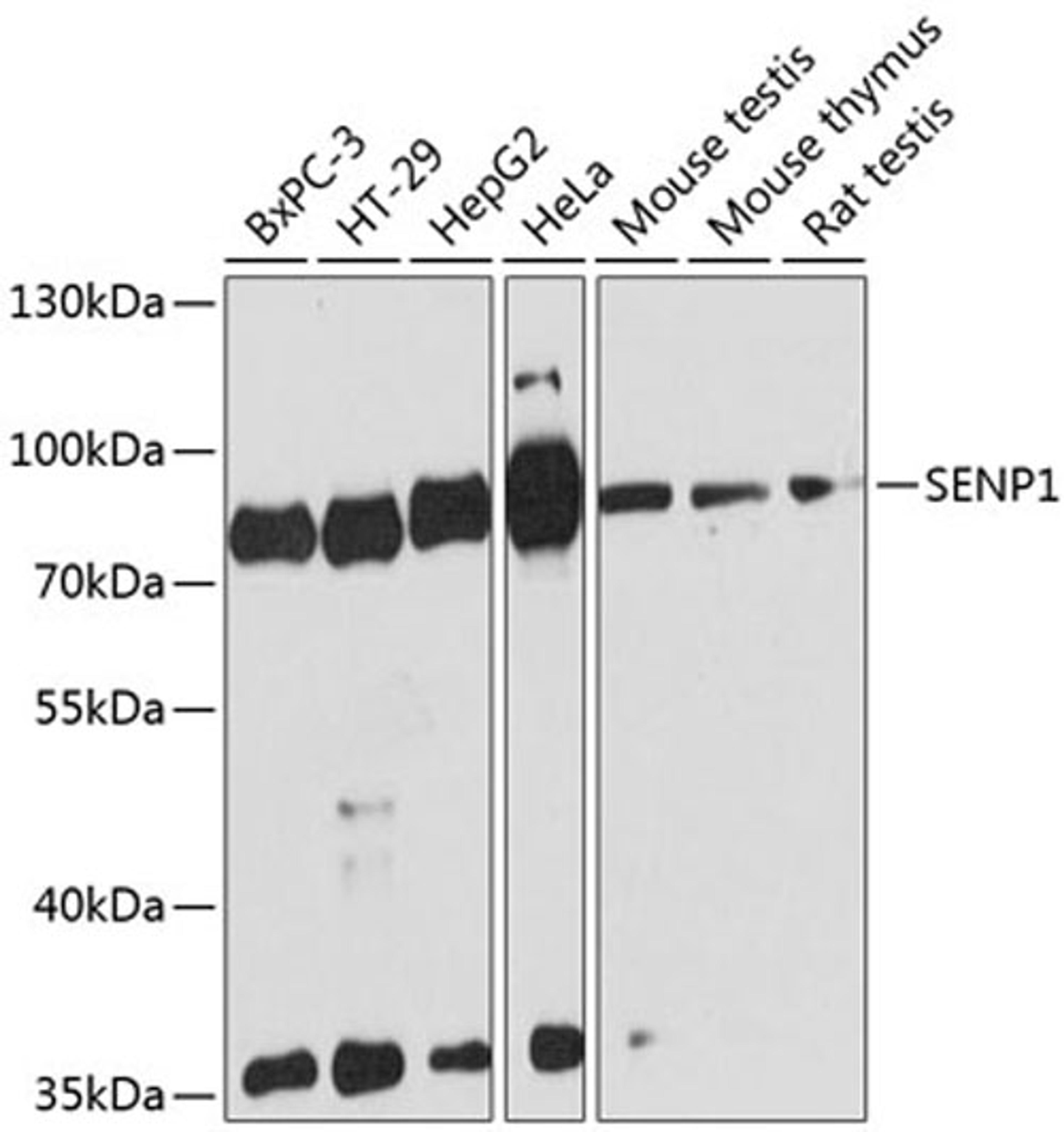 Western blot - SENP1 antibody (A13086)