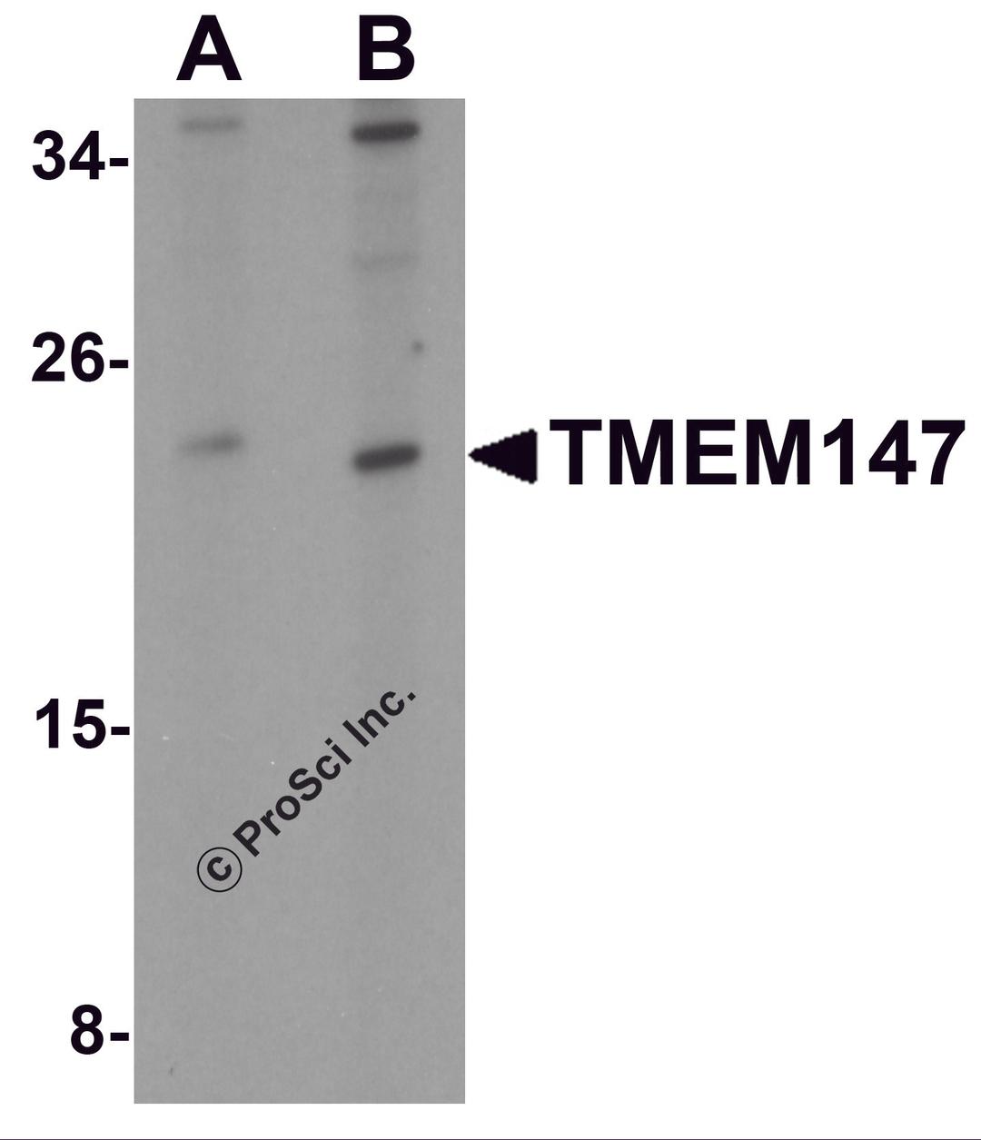 Western blot analysis of TMEM147 in Daudi cell lysate with TMEM147 antibody at (A) 1 and (B) 2 μg/mL.