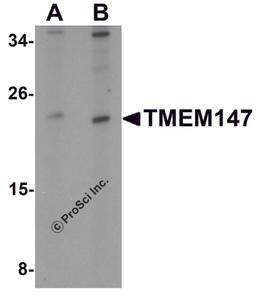 Western blot analysis of TMEM147 in Daudi cell lysate with TMEM147 antibody at (A) 1 and (B) 2 μg/mL.