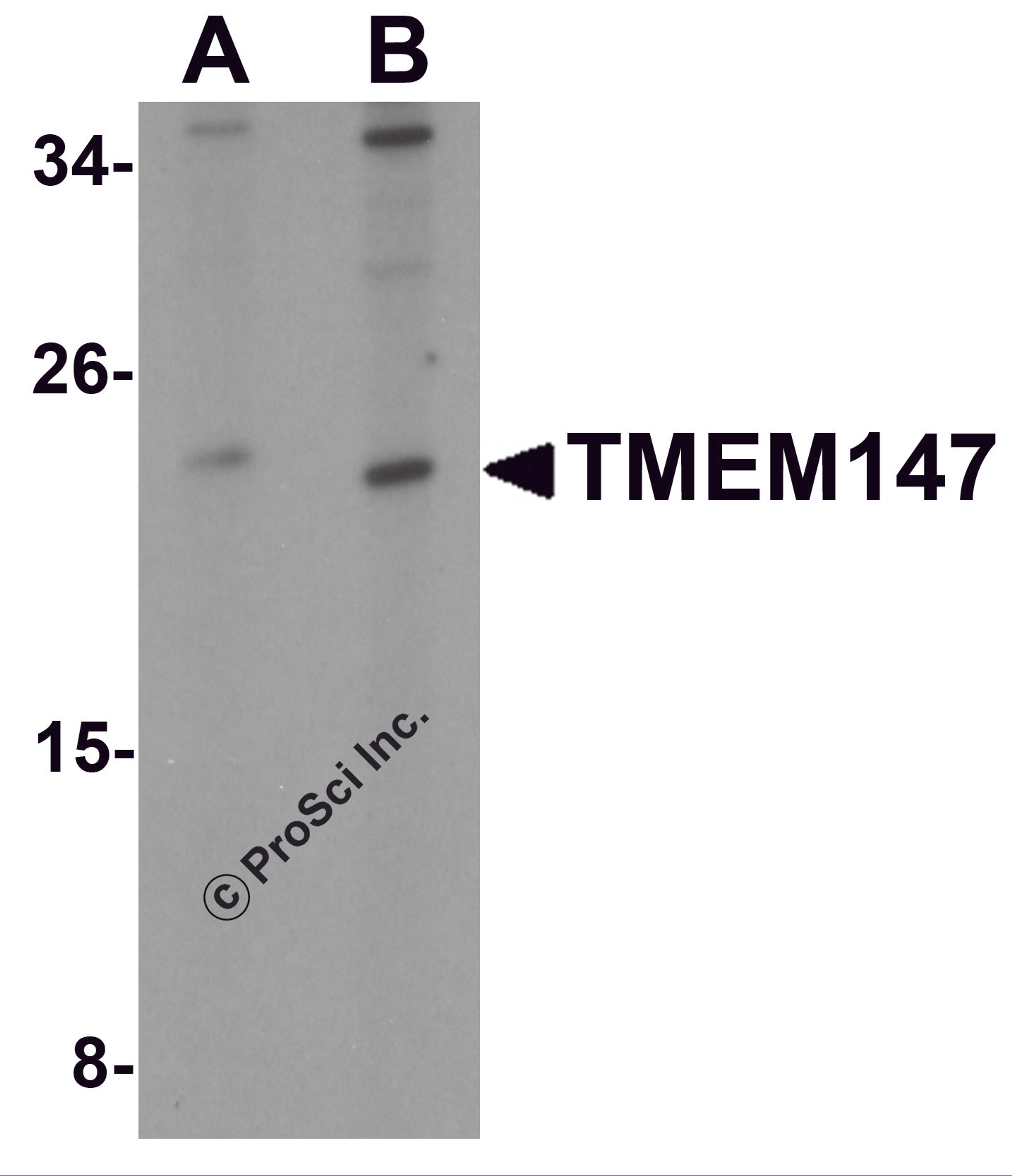 Western blot analysis of TMEM147 in Daudi cell lysate with TMEM147 antibody at (A) 1 and (B) 2 μg/mL.