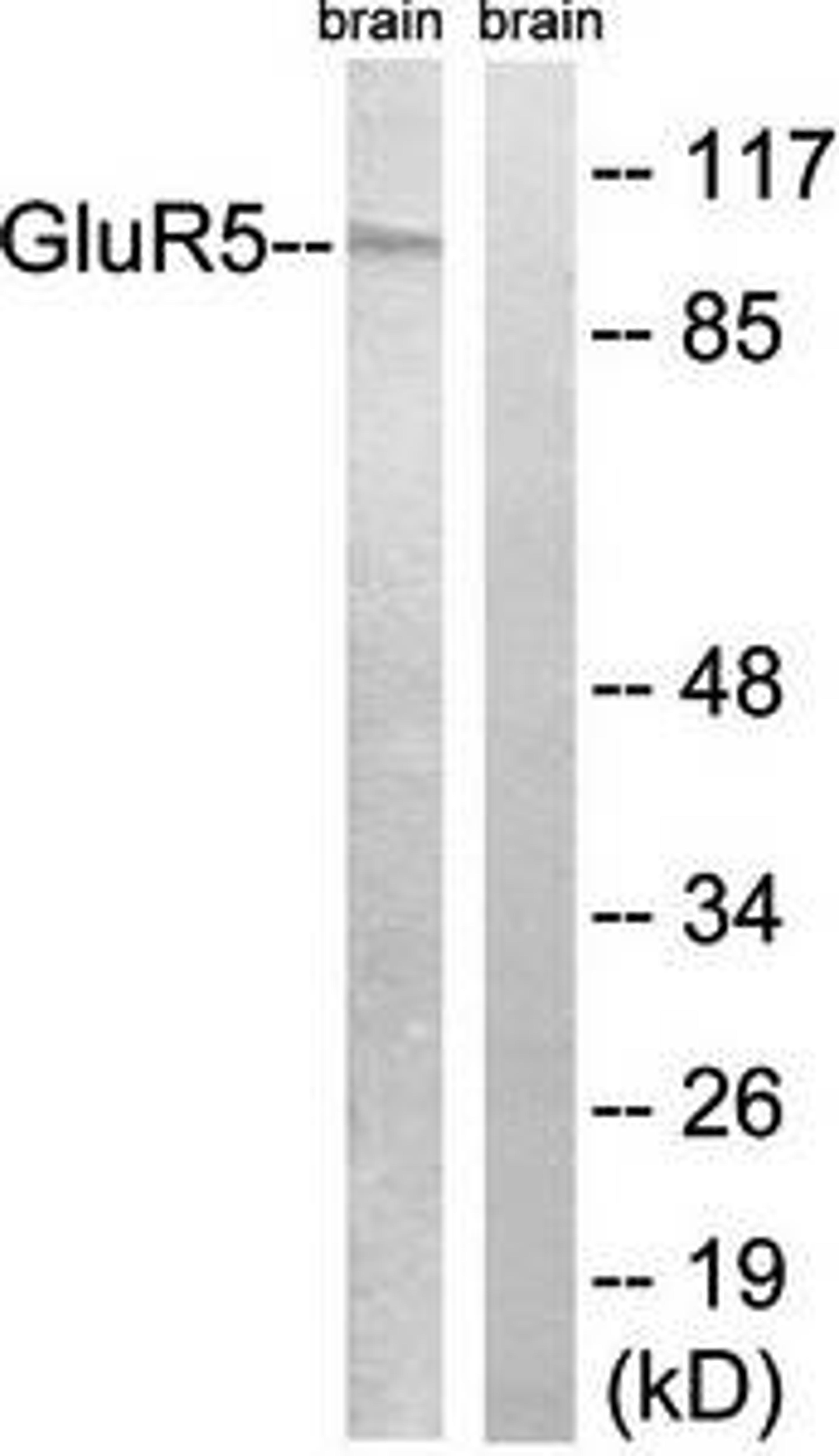 Western blot analysis of extracts from mouse brain using GluR5 antibody