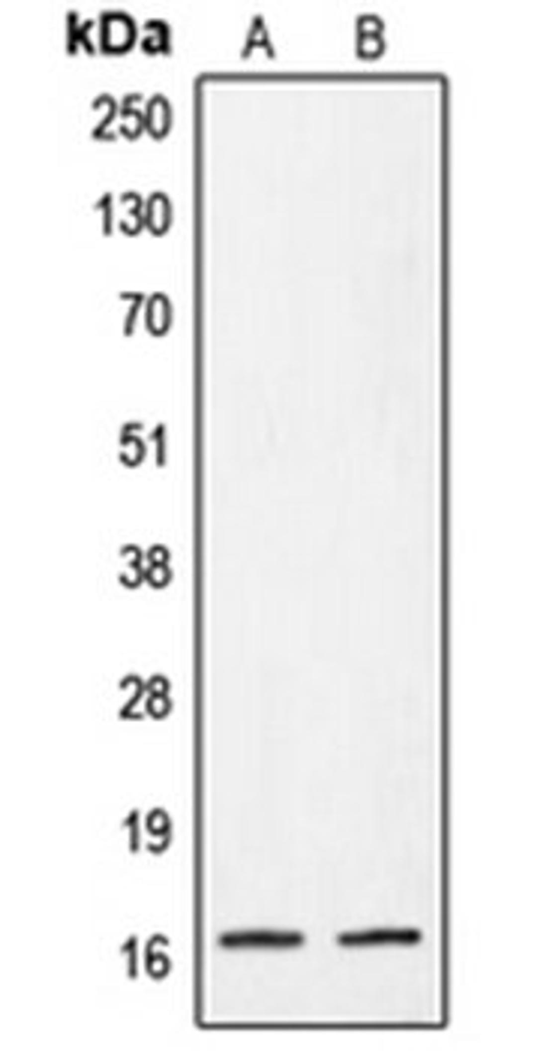 Western blot analysis of A431 (Lane 1), HeLa (Lane 2) whole cell lysates using CRABP2 antibody