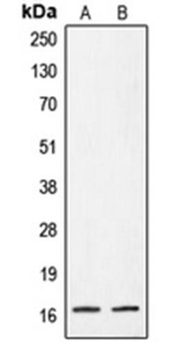 Western blot analysis of A431 (Lane 1), HeLa (Lane 2) whole cell lysates using CRABP2 antibody