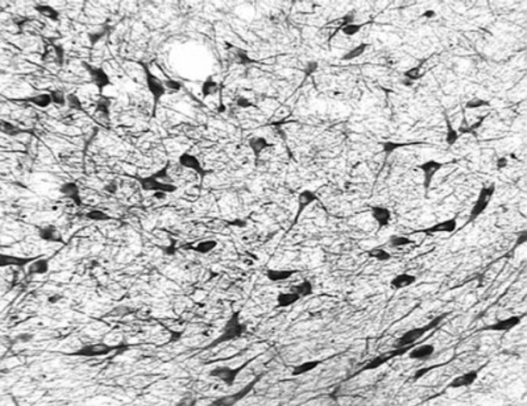 Immunohistochemistry-Frozen: Ogg1 Antibody [NB100-106] - Detection of OGG1 in formaldehyde fixed frozen sections of the substantia nigra from a Rhesus macaque (Macaca mulatta) using NB100-106 at 10 ug/ml. Photo courtesy of Glen Kisby, Oregon Health Sciences University