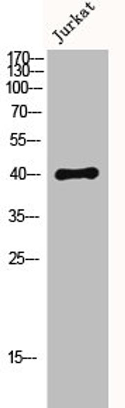 Western Blot analysis of Jurkat cells using MKP-1/2 Polyclonal Antibody
