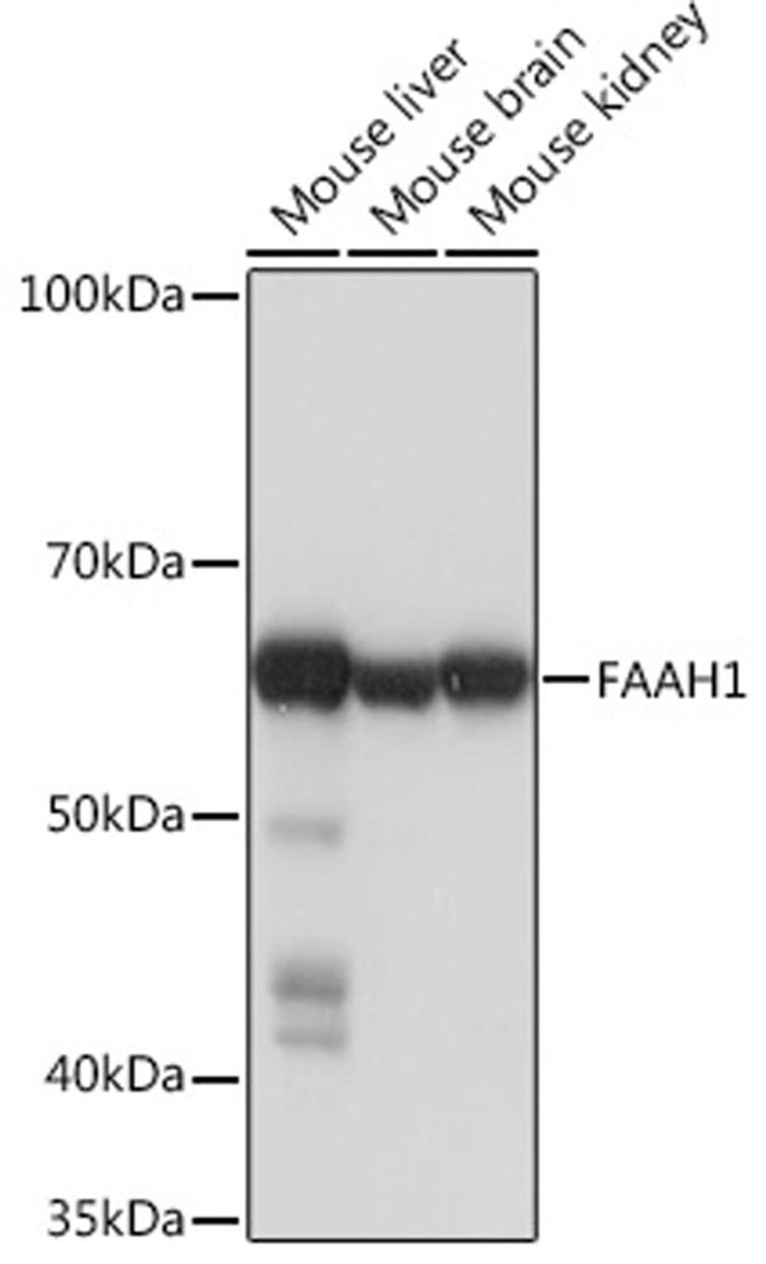 Western blot - FAAH1 Rabbit mAb (A4099)