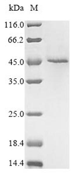 (Tris-Glycine gel) Discontinuous SDS-PAGE (reduced) with 5% enrichment gel and 15% separation gel.