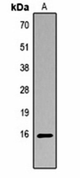 Western blot analysis of  Hela TSA-treated (Lane1) whole cell lysates using Histone H3 (AcK14) antibody