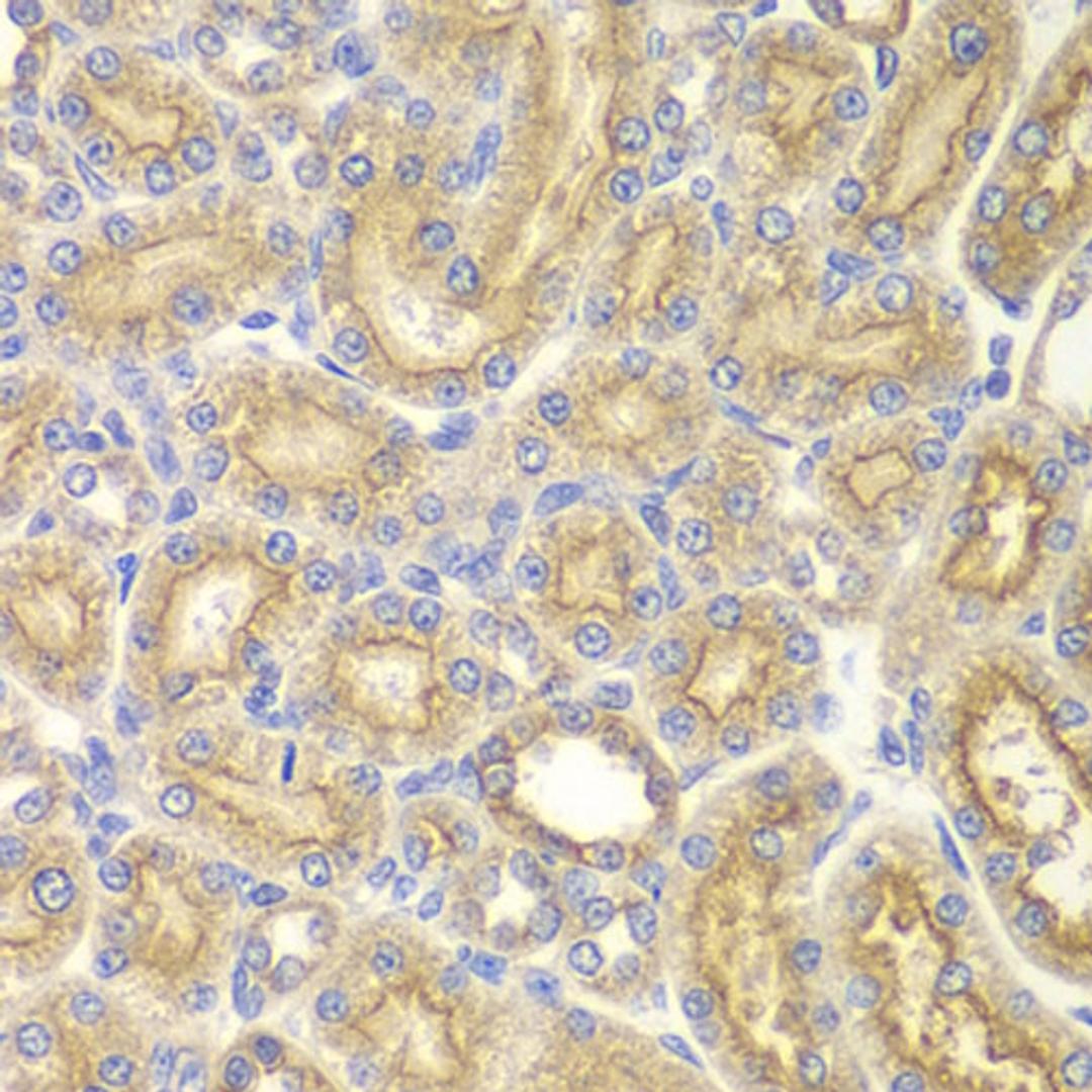 Immunohistochemistry  - PAK1 antibody (A0809)