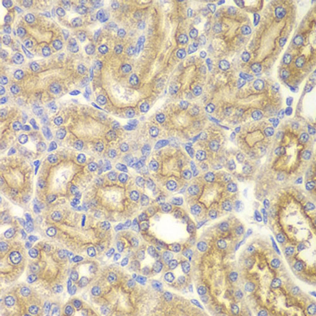 Immunohistochemistry - PAK1 antibody (A0809)