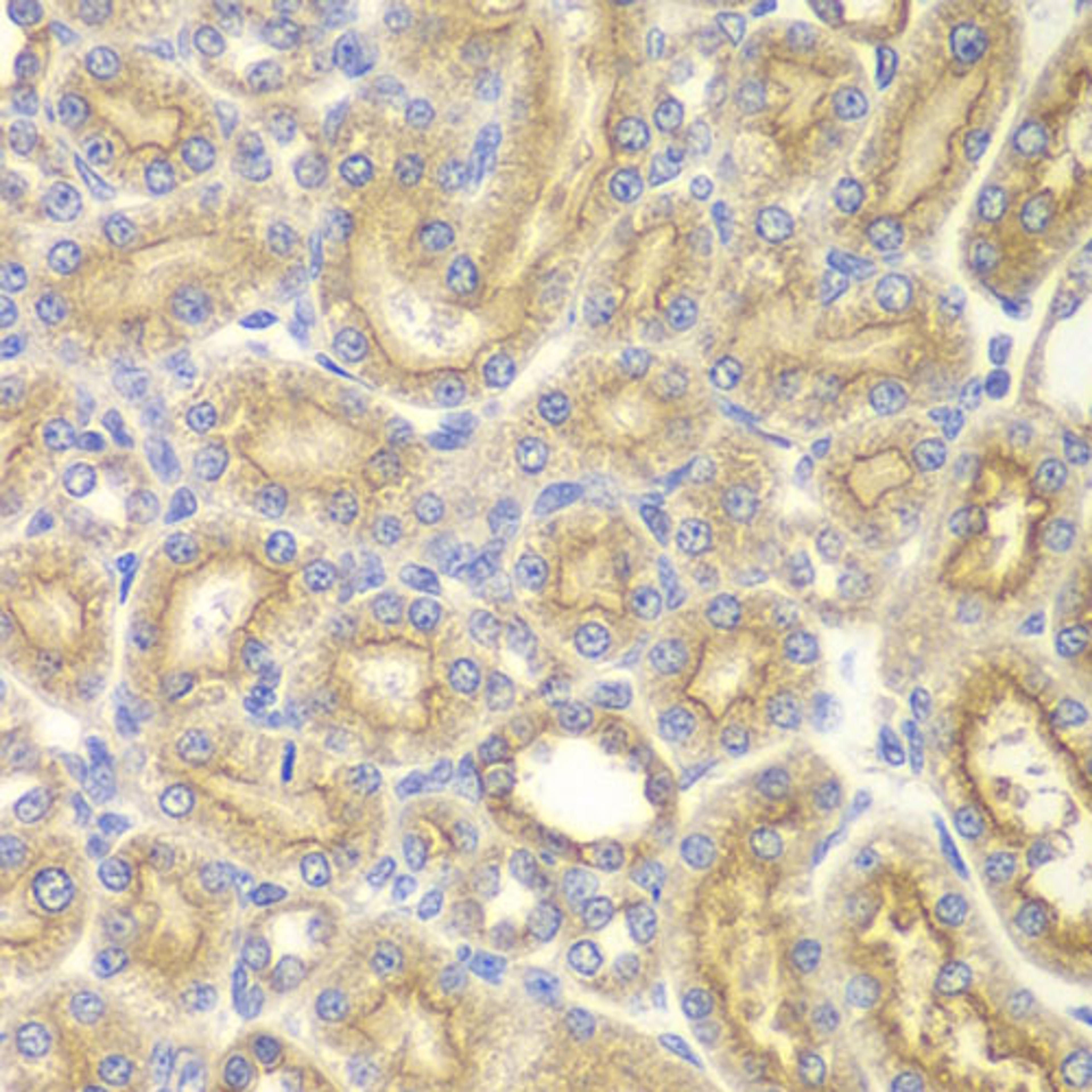 Immunohistochemistry - PAK1 antibody (A0809)