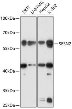 Western blot - SESN2 antibody (A14220)