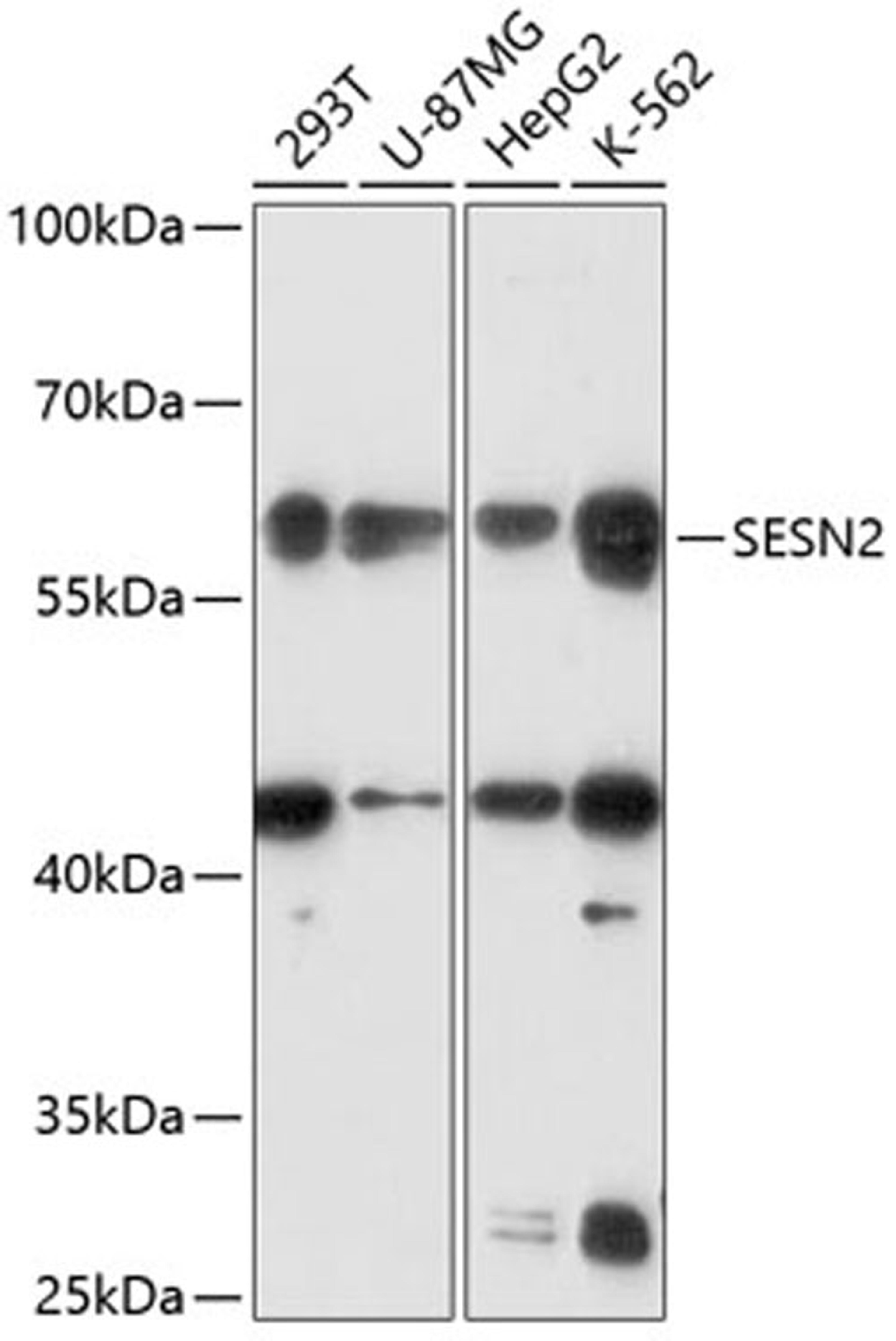 Western blot - SESN2 antibody (A14220)