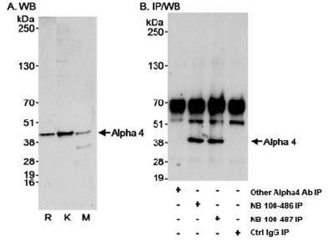 Immunoprecipitation: IGBP1 Antibody [NB100-487] - Detection of Alpha-4 by Western Blot and Immunoprecipitation. Samples: A. Whole cell lysate (50 mcg) from Ramos (R), K562 (K) and mouse NIH3T3 (M) cells. B. Whole cell lysate (1 mg/IP; 1/4 of IP reaction loaded/lane) from Ramos cells. Antibodies: NB 100-487 used at 0.4 mcg/ml (A) and 1 mcg/ml (B) for WB at 3 mcg/mg lysate for IP. Alpha-4 was also immunoprecipitated by NB 100-486, but not by another Alpha-4 antibody, which are both affinity purified antibodies to upstream epitopes on Alpha-4. Detection: Chemiluminescence with an exposure time of 30 seconds (A and B).