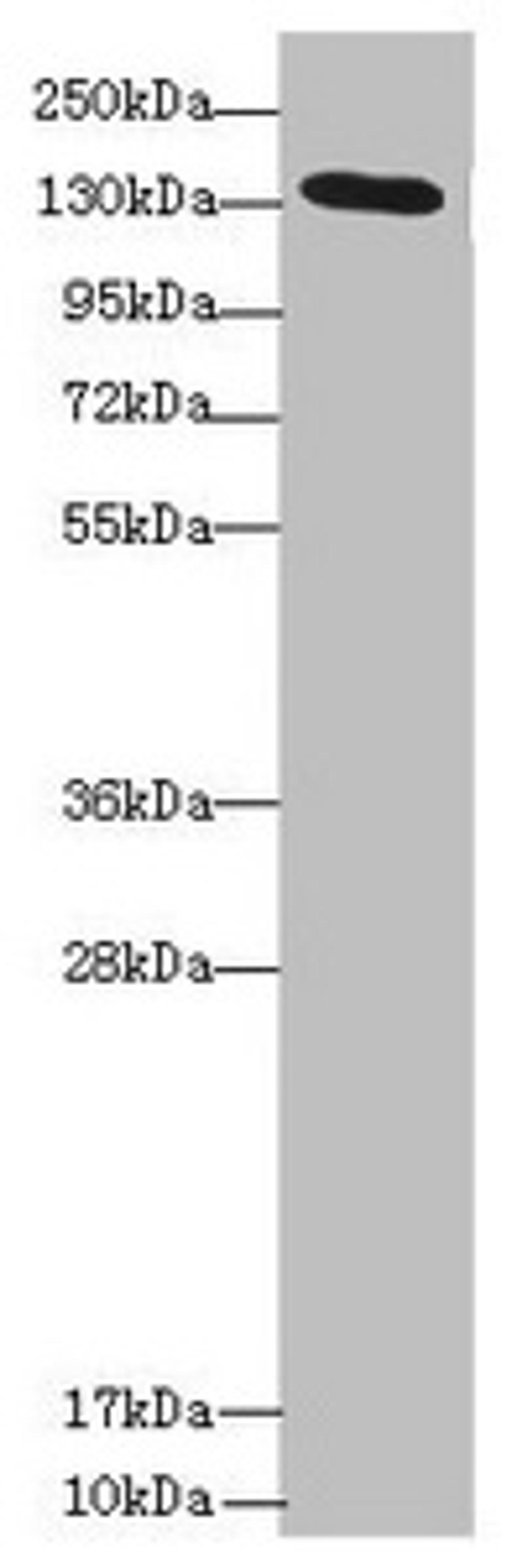 Western blot. All lanes: NPHP3 antibody at 1.57 ug/ml + Mouse gonadal tissue. Secondary. Goat polyclonal to rabbit IgG at 1/10000 dilution. Predicted band size: 151, 74, 72, 20, 27, 80, 16 kDa. Observed band size: 151 kDa.